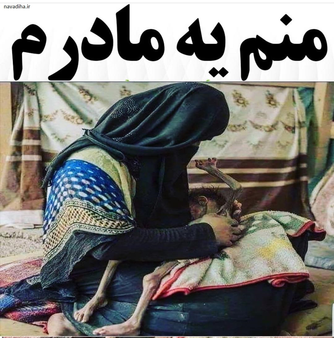آمار وحشتناک از مرده بدنیا آمدن کودکان یمنی